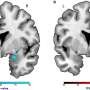 Imaging study shows what your favorite film genres reveal about your brain